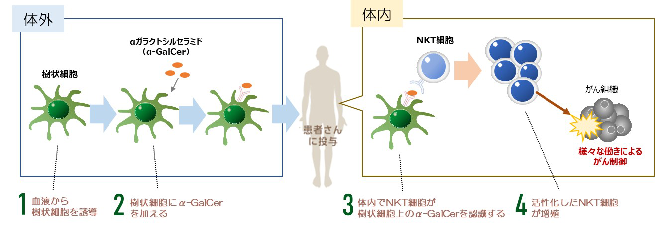 NKT細胞療法